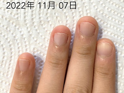 【経歴】 爪 が 早く 伸びる 方法 話題のSns投稿まとめ 2026 #952