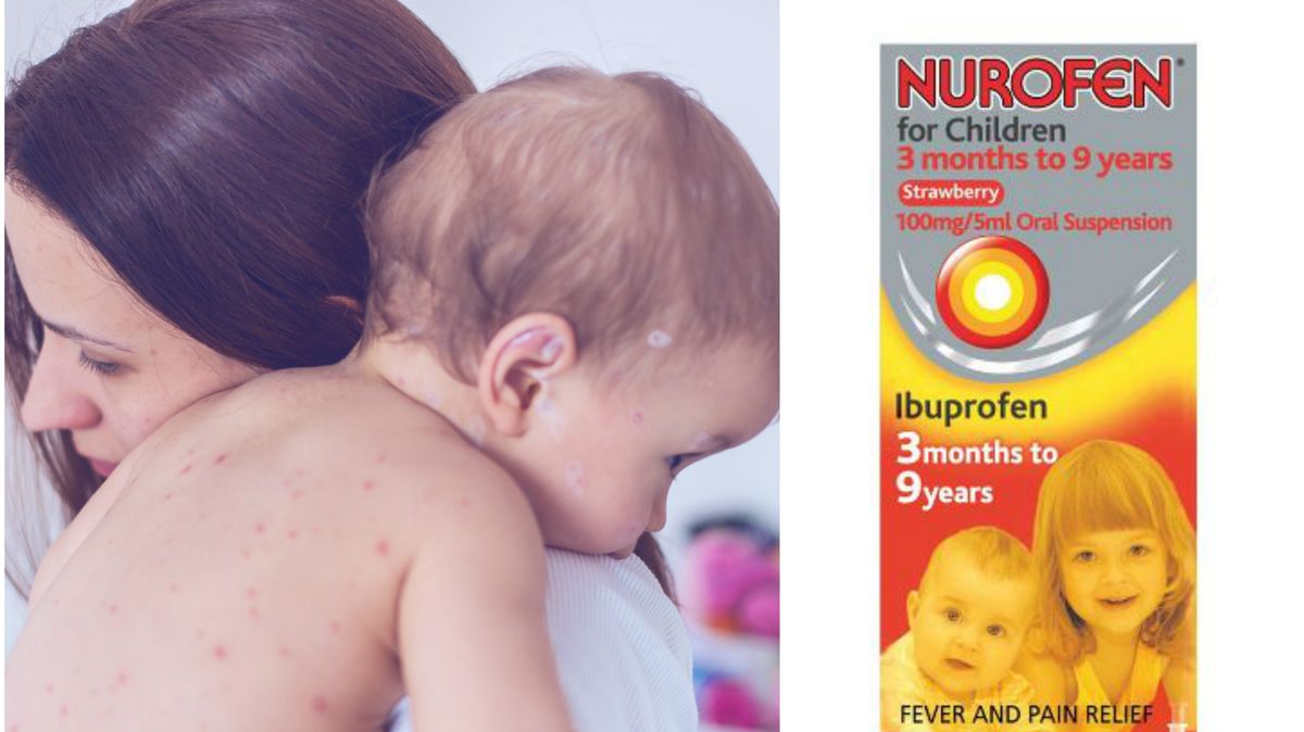 I've Given My Child Nurofen with Chickenpox