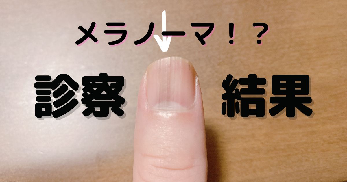 松坂桃李の親の職業とは？大学教授の父が語る厳格な教育方針の真実