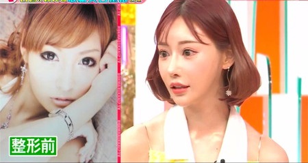 【まとめ】 明日 花 キララ 整形 歴代彼氏・彼女まとめ #975