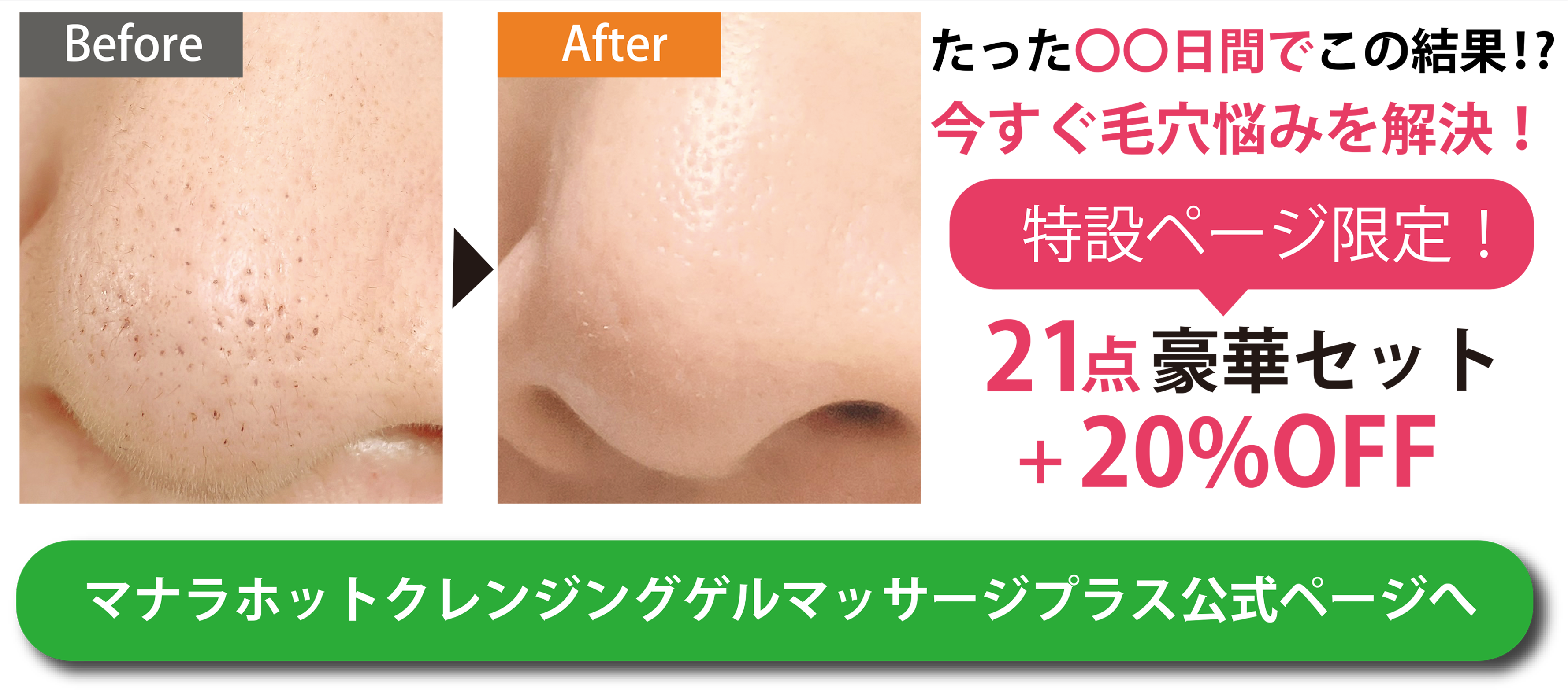 毛穴の黒ずみは皮膚科で治る？保険適用と最新美容治療の費用と効果
