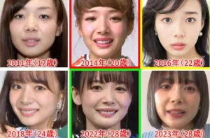 【まとめ】 岡田 紗 佳 整形 2026年最新芸能速報 #626