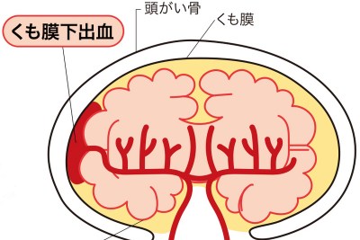【話題】 星野 源 くも膜 下 出血 最新ライブ＆イベント情報 #924