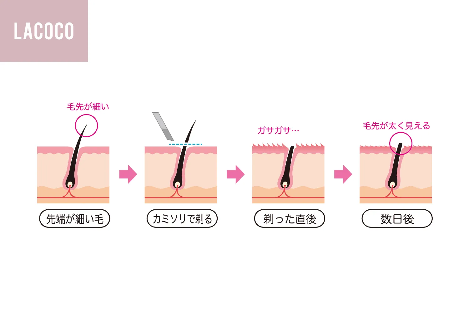 「毛を剃ると濃くなる」噂の真相と医学的根拠｜太く見える理由を徹底解明
