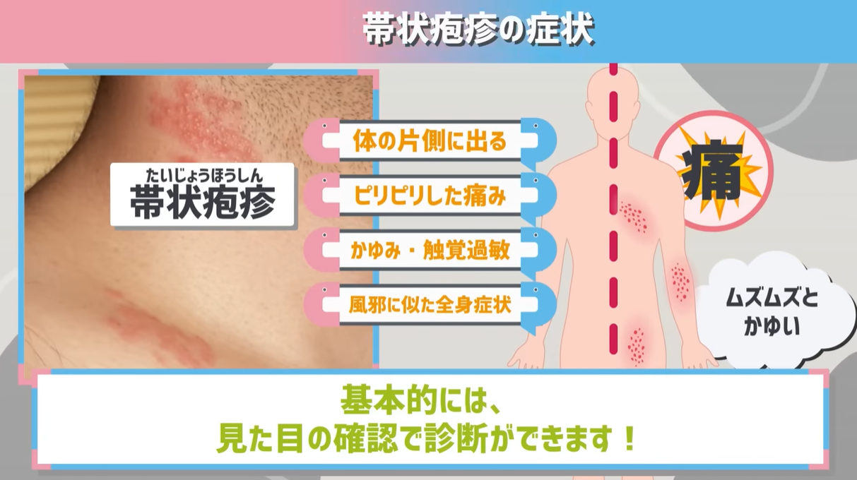 帯状疱疹が人にうつる期間は？乳幼児・妊婦への感染リスクと家庭内予防策