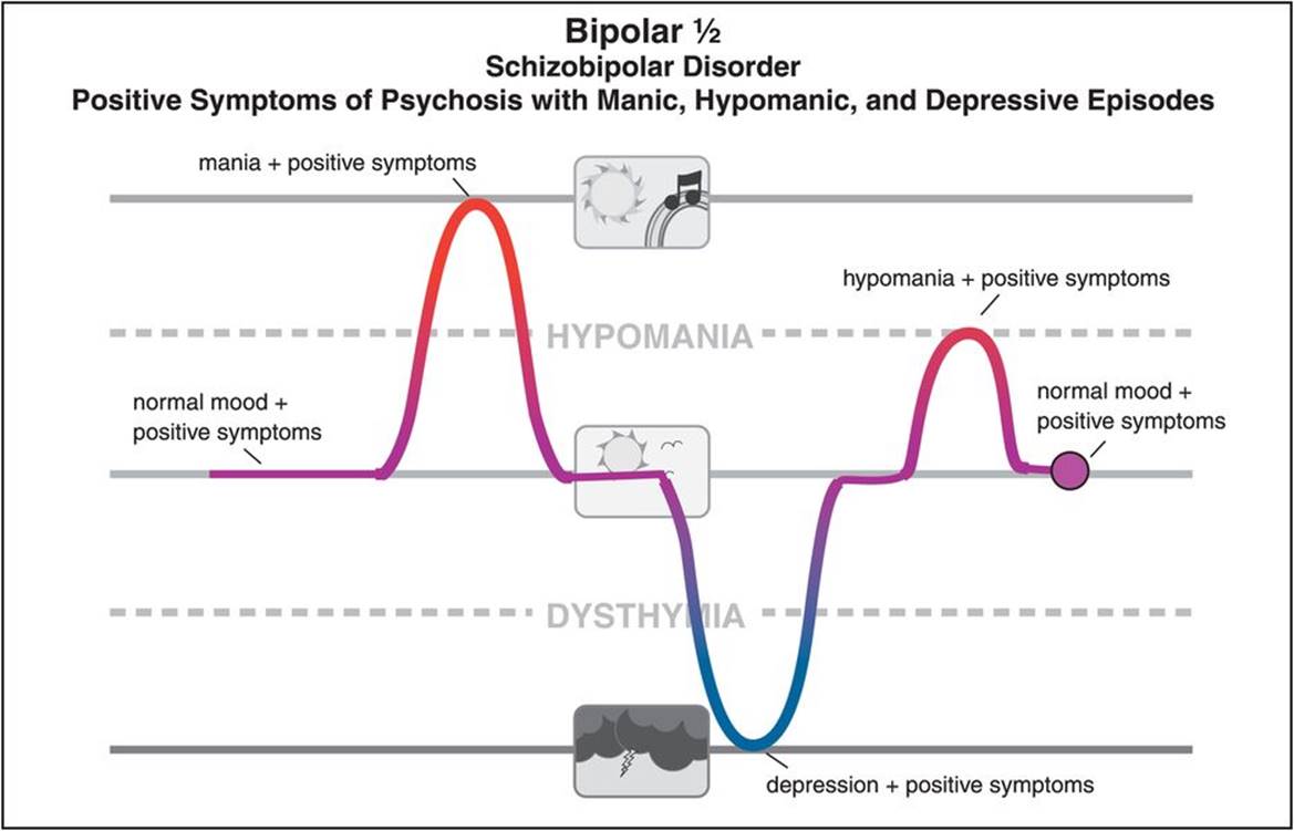 Bipolar with Psychotic Features Delusions and Hallucinations Occur During Severe Mood Episodes